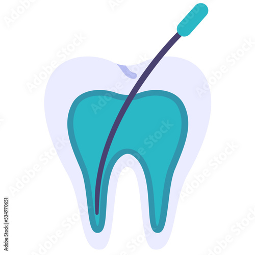 Root canal
