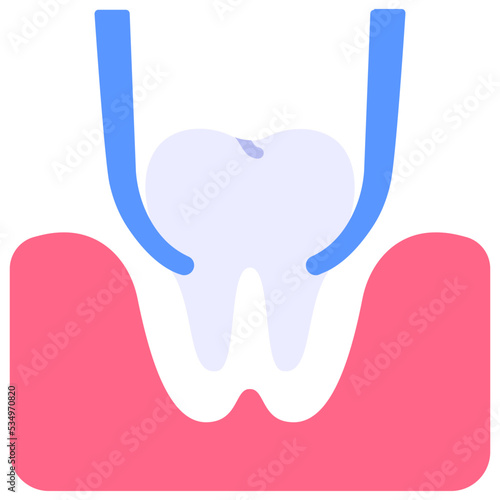 Tooth extraction