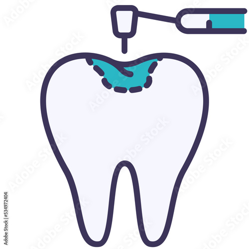 Filling tooth
