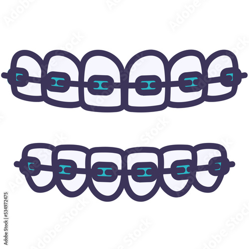 Braces