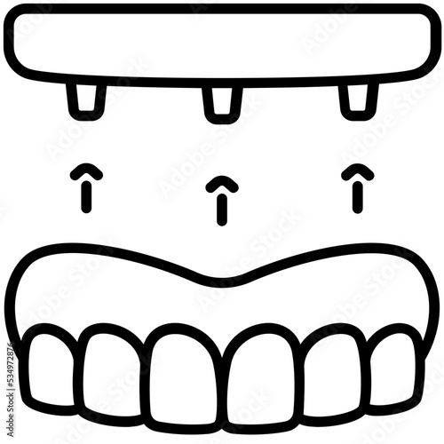 Dentures screw