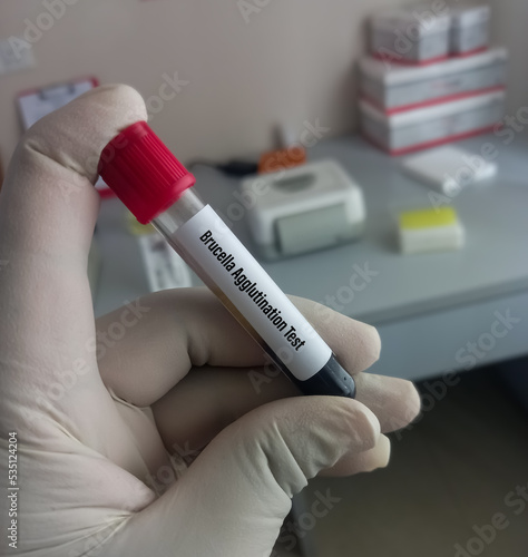 Blood sample for Brucella agglutination test to diagnosis of brucellosis. photo