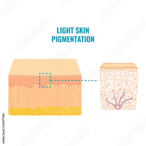 Melanin content and distribution in light skin. Fair complexion pigmentation mechanism infographic diagram. Epidermis cross-section in closeup. Vector illustration.