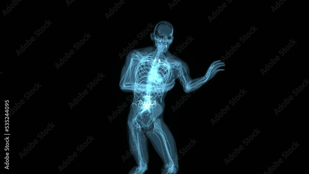 Abstract animation of a heart attack in xray Abstract animation of a heart attack in xray