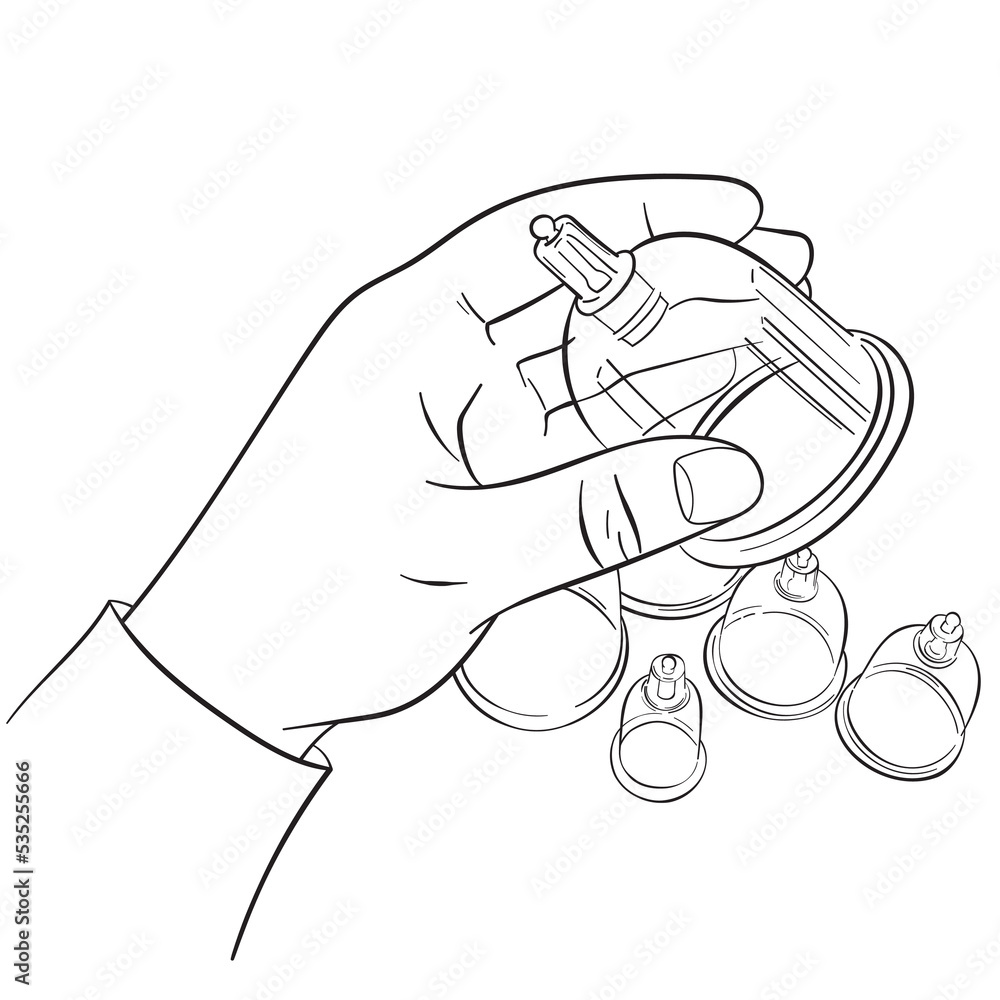 A hand holds a jar for bloodletting, a line drawing.