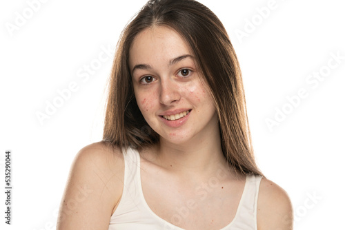 beautiful young smiling women with problematic skin.