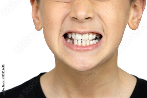 Oral health and hygiene. Boy grinding his teeth on a white background
