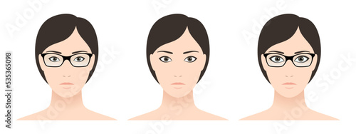 Woman with glasses,  negative and positive number of diopters