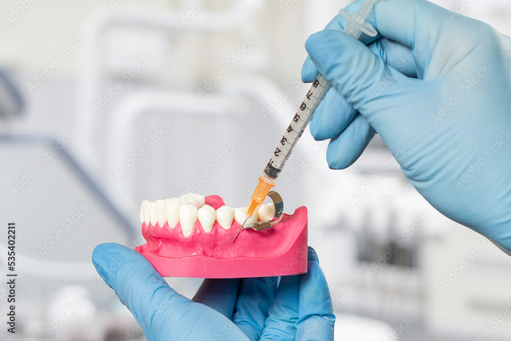 Dentist with layout of the human jaw and syringe. Stock Photo Adobe Stock