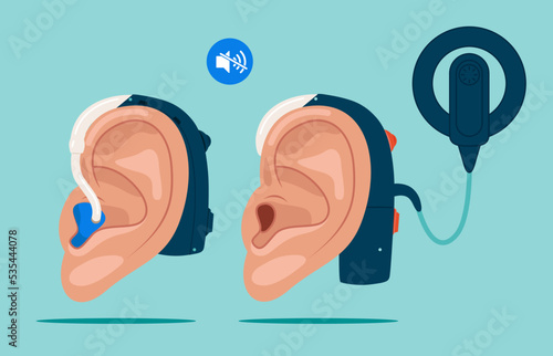 Cochlear implant and hearing aid. World Deaf Day in last Sunday of September. Flat vector illustration.