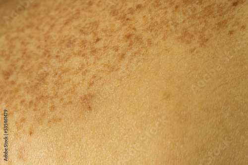 Texture of human skin as background, closeup view