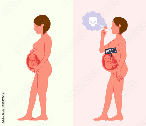 Happy pregnant woman with healthy fetus baby inside her belly and smoking woman with a child asking for help vector illustration