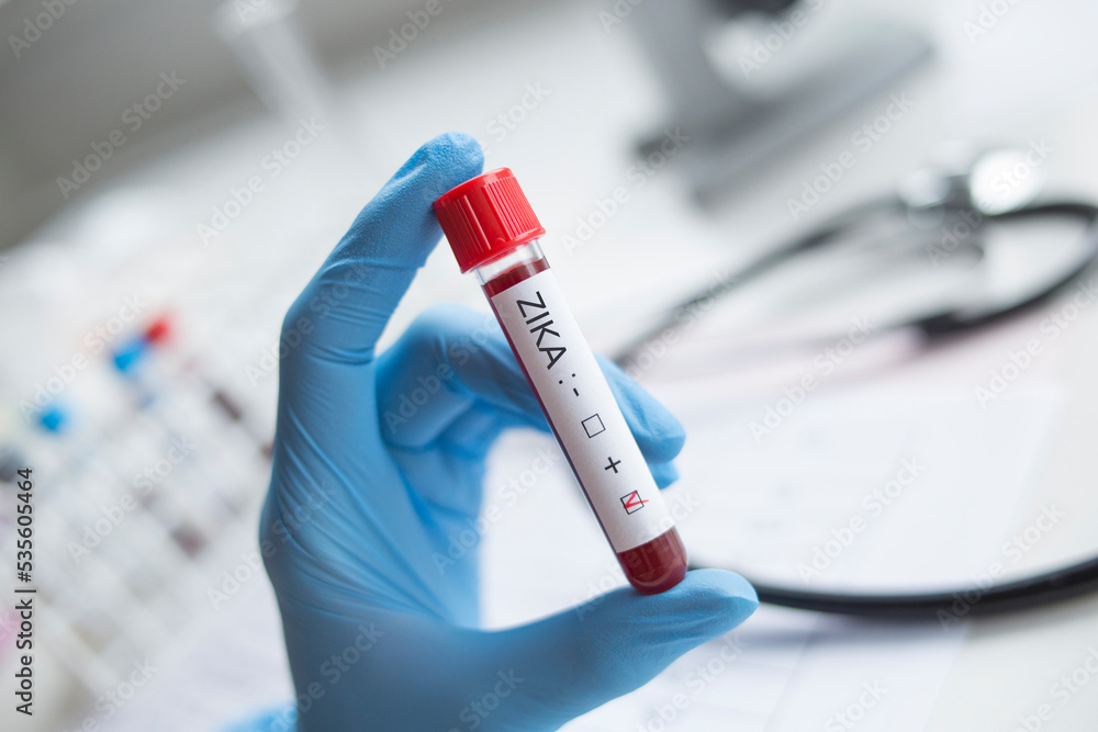 Fototapeta premium Laboratory: Blood sample positive with ZIKA virus.