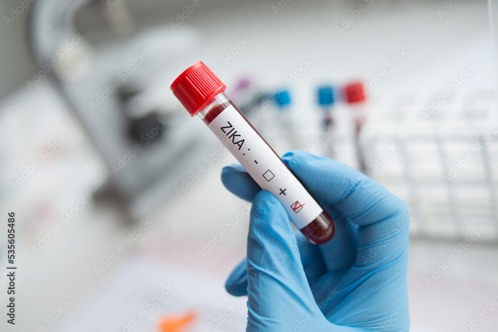 Fototapeta premium Laboratory: Blood sample positive with ZIKA virus.