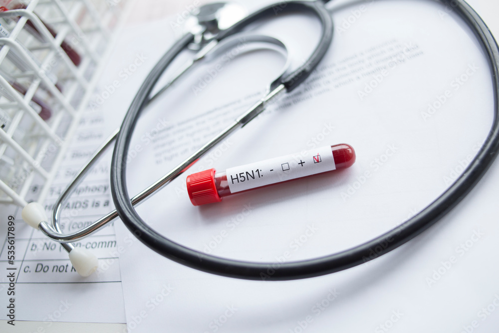 Laboratory: Blood sample positive with H5N1 influenza virus. Laboratory: Blood sample positive with H5N1 influenza virus.