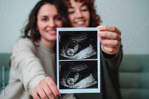 Happy gay lesbian couple holding ultrasound photo scan at home - Lgbtq surrogate pregnancy concept photo