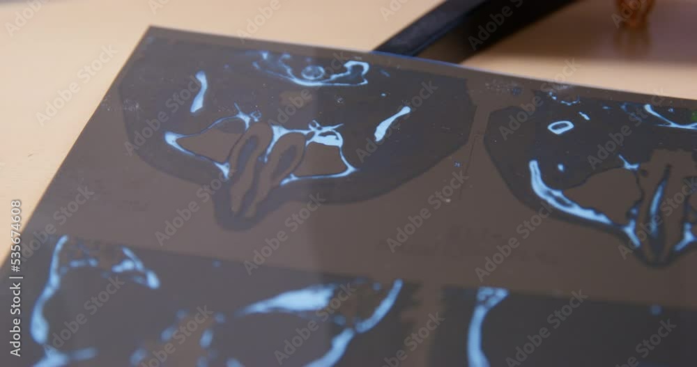 Dog paw showing x-ray of nose close up. Anomaly pathology consultation