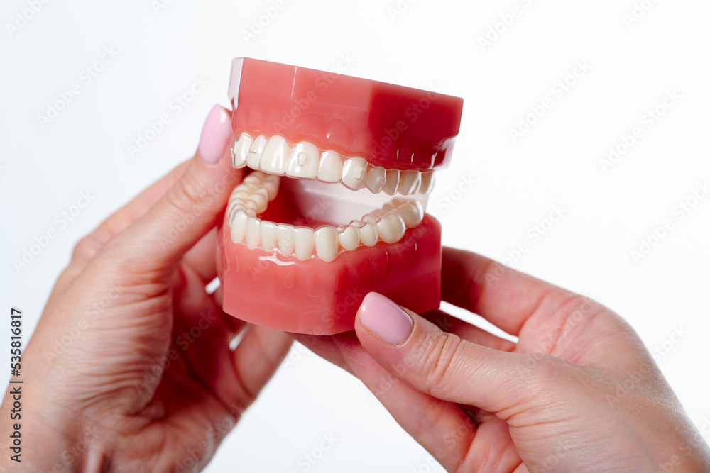 Stockfoto med beskrivningen Dental model with orthodontic appliance