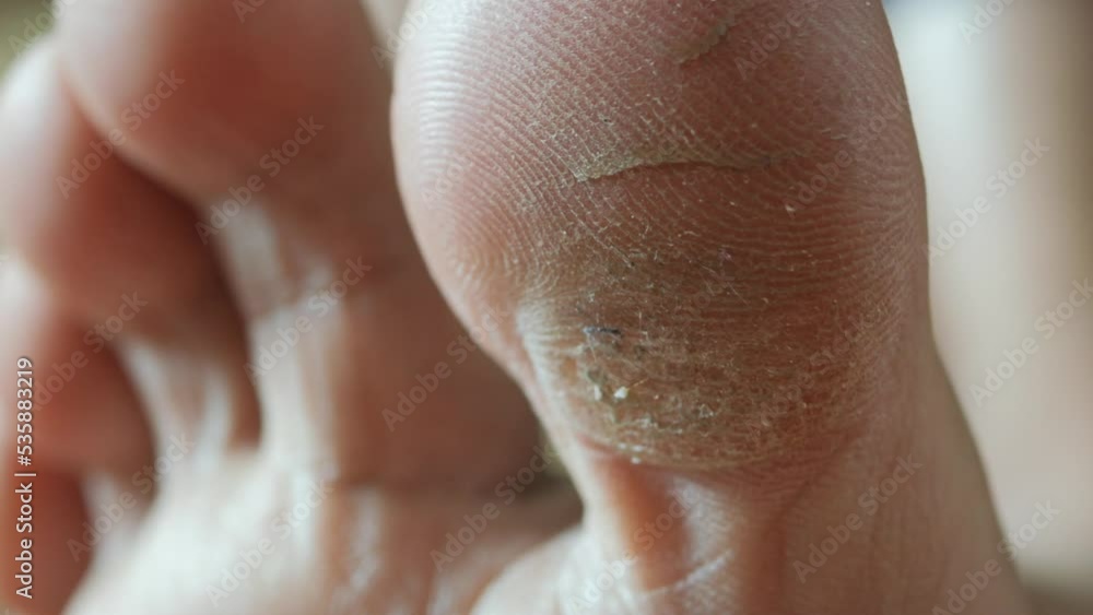 close up of young men dry feet on bed , close up of young men dry feet on bed ,