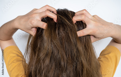 Rear view of young woman while scratching her scalp caused of itchy scalp.