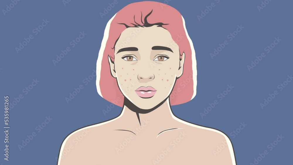 girl with acne. character animation girl with acne. character animation