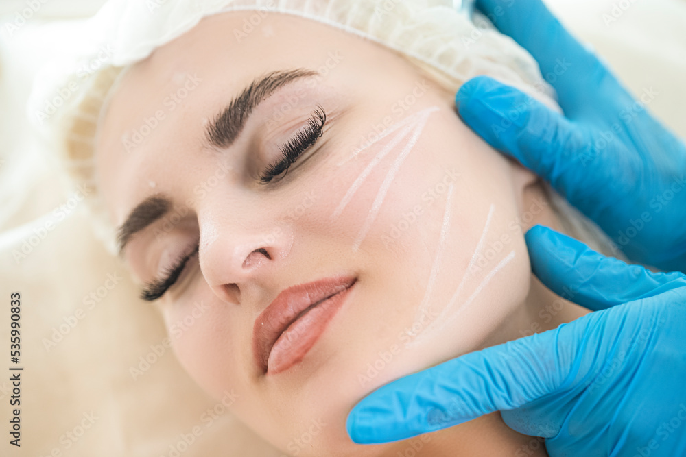 Skincare Concept. Woman During Facial Beauty Treatment While Preparing for Pigmentation Removal by Using Facial Pencil Markup at Cosmetic Clinic Before Intense Pulsed Light Therapy