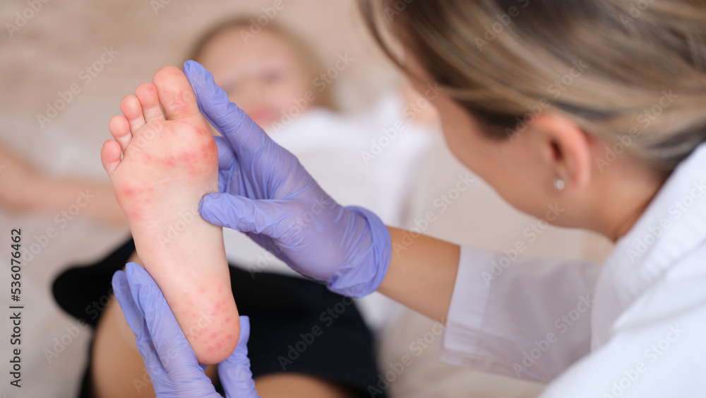 Doctor conducts medical examination of leg of child with red itchy rash