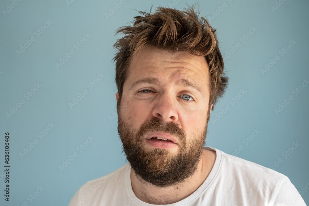Bearded man with tousled hair and swollen, barely open eyes after a sleepless night, he suffers and looks bad. Blue background. Bearded man with tousled hair and swollen, barely open eyes after a sleepless night, he suffers and looks bad. Blue background.