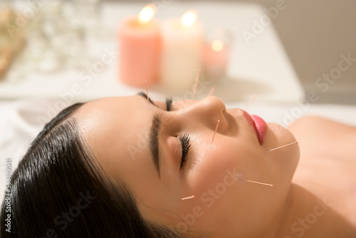 Photography Beautiful Woman Received acupuncture treatment on face by  therapist, chinese medicine treatment, health and healing concept