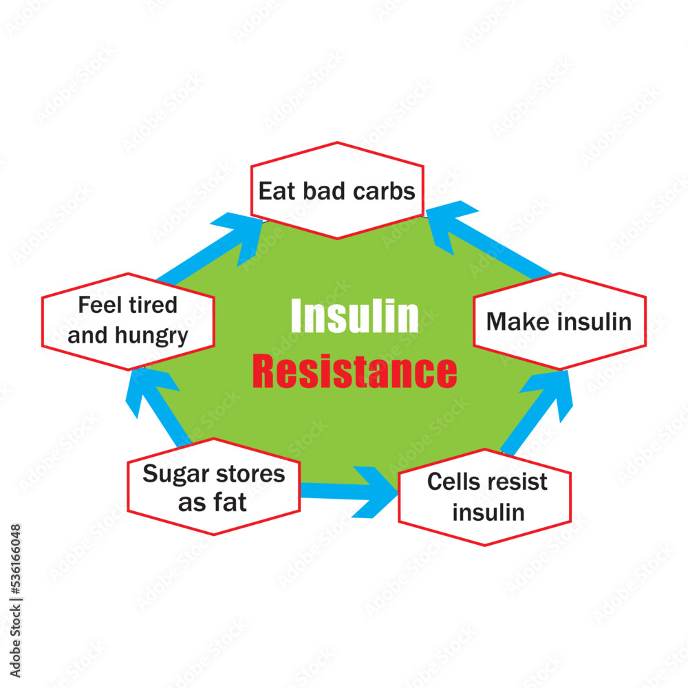 Insulin cycle before and after eat. Insulin resistance diagram. Vector