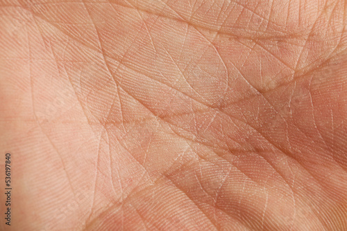 Wallpaper Mural Closeup view of human palm with dry skin Torontodigital.ca