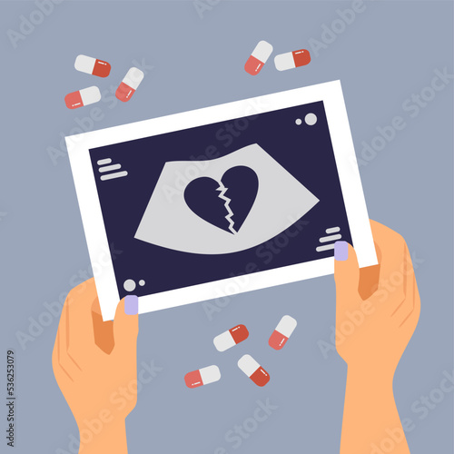 torn shot of ultrasound in hands with pills on background, abortion, miscarriage, pregnant woman, unborn, hospital birth, no children, pills, medical abortion, fetus, embryo, pregnancy, infertility