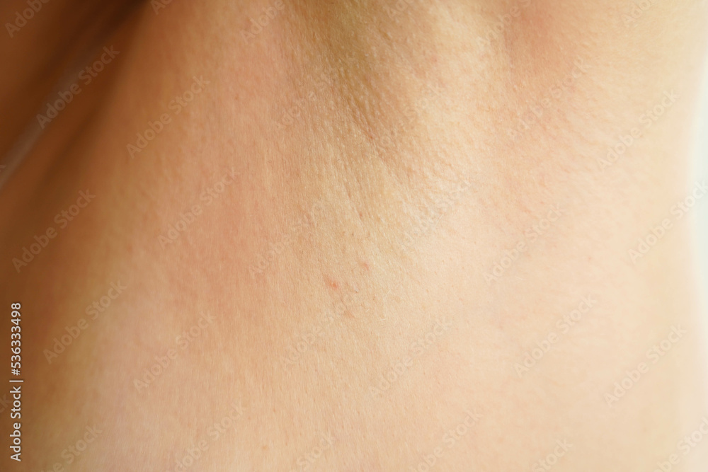 Women's armpit close-up. Thin and sparse hair on a female armpit. The result after completing an incomplete course of laser hair removal. Women's armpit close-up. Thin and sparse hair on a female armpit. The result after completing an incomplete course of laser hair removal.