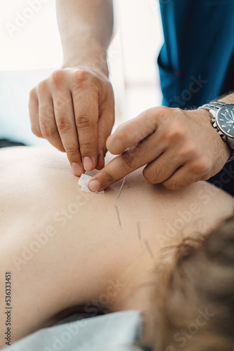 фотографія Woman stabbed in the back with needle in bright acupuncture clinic