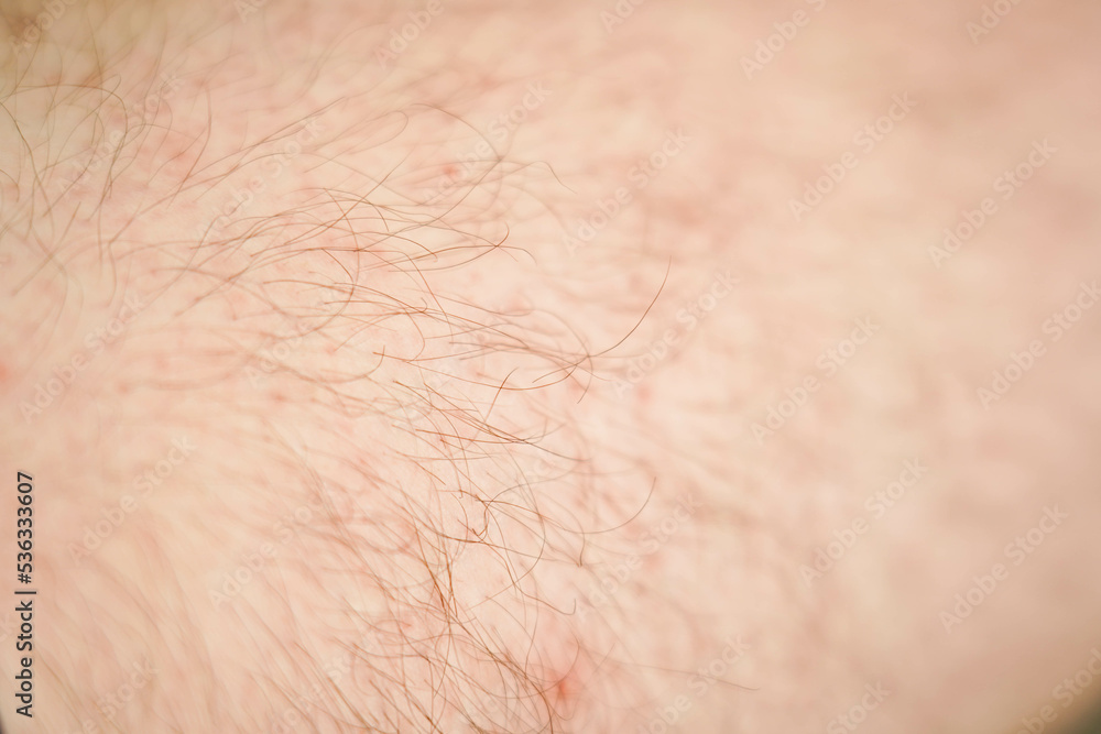 Fototapeta premium Close-up of hairy skin. Hair on a man's leg