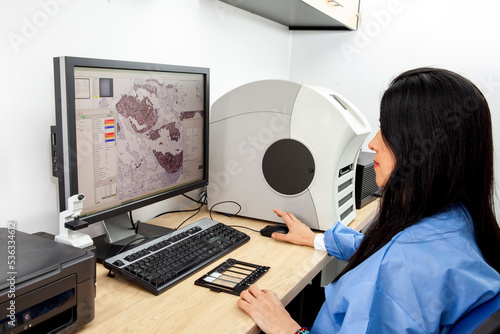 Young female scientist scanning microscope slides with tissue samples for pathology studies. Cancer diagnosis concept. Medical technology concept. photo