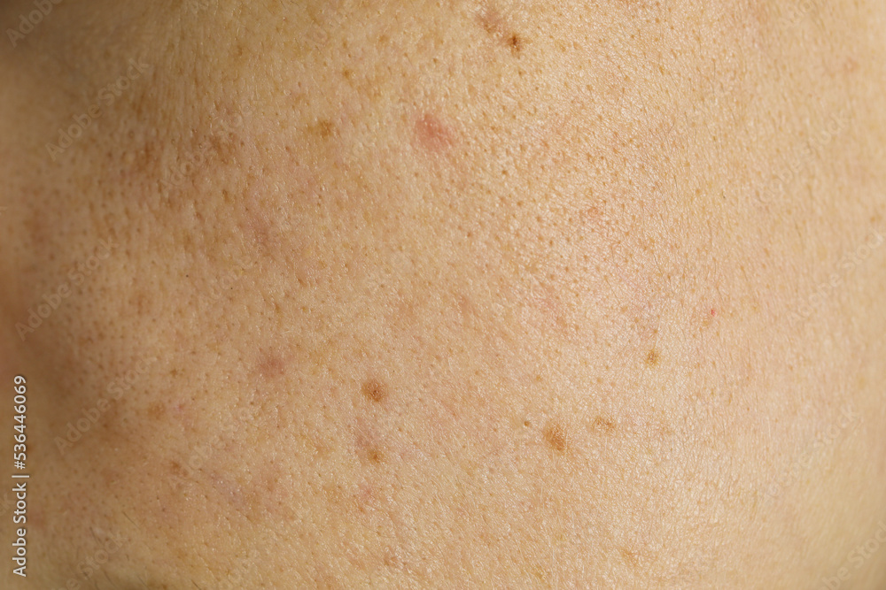 Fototapeta premium Texture of human skin as background, closeup view