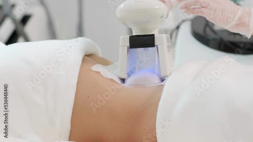Сryolipolysis fat treatment procedure in the modern cosmetology clinic photo