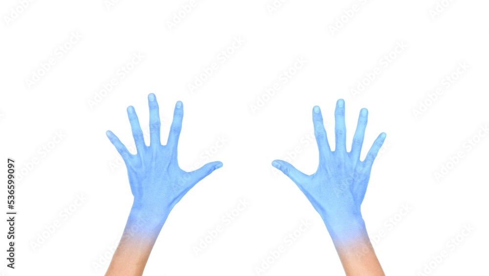 Two opened hands with light blue color of Asian man. Concept of cold and clumsy hand.