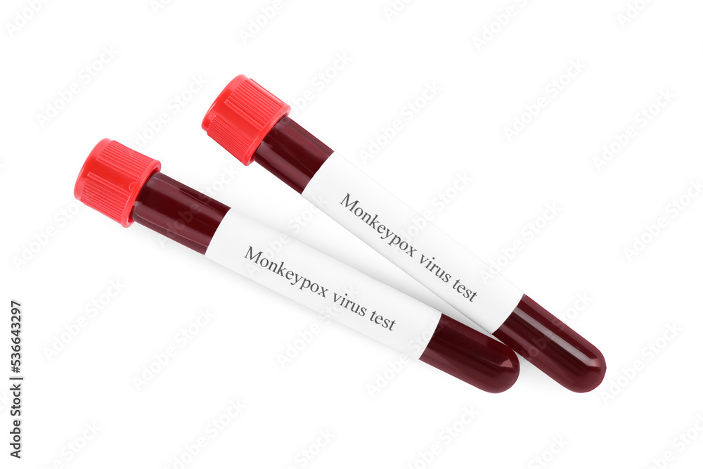 Monkeypox virus test. Sample tubes with blood on white background Monkeypox virus test. Sample tubes with blood on white background