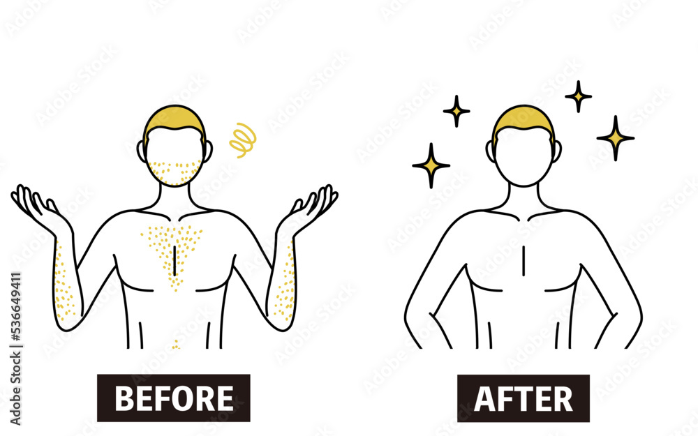 Image of medical hair removal, beforeandafter of a man with thick