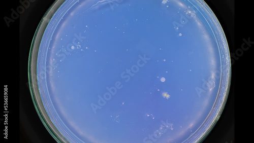 growth of bacteria in a petri dish samples taken in the trading floor of the store timelapse