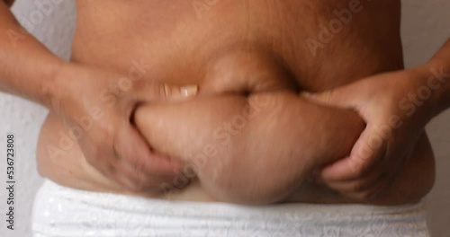 Close up of woman's belly with stretch mark loose lower abdomen skin she fat after pregnancy baby birth, studio isolated, unhealthy belly overweight excess body concept