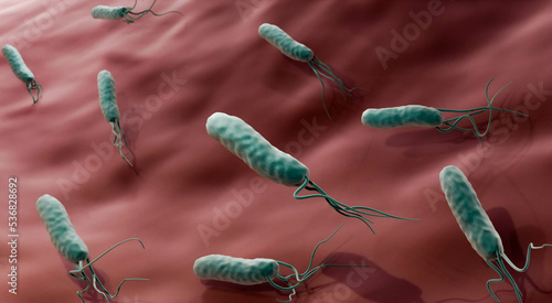 Helicobacter pylori is a bacteria causing ulcers and gastritis photo