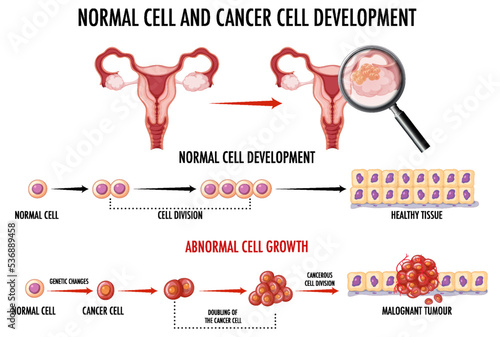 Diagram showing normal and cancer cells