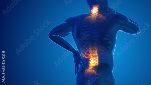 Foto Pain in the back and neck joint