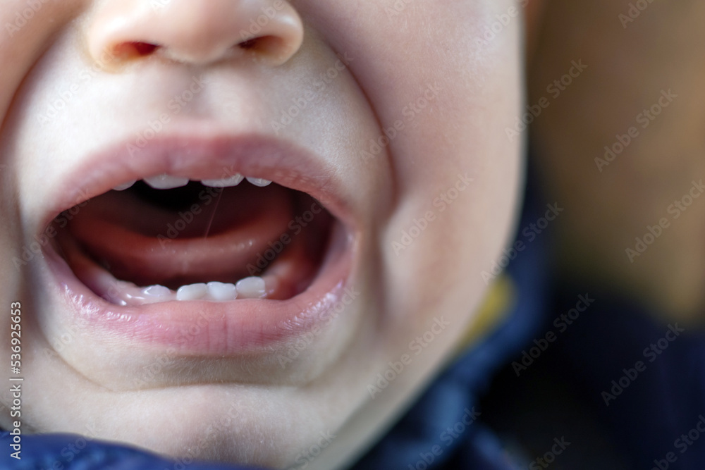 face details parts of baby boy child kid.angry nervous toddler crying