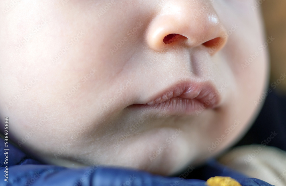 Foto de face details parts of baby boy child kid.angry nervous toddler ...