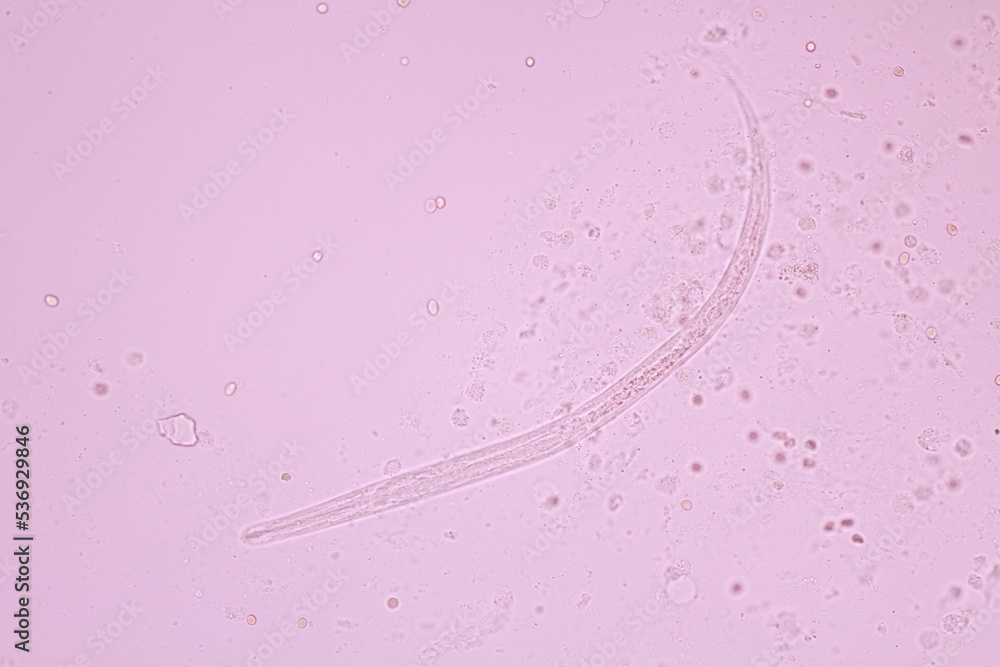 View in microscopic Strongyloides stercoralis or threadworm in human