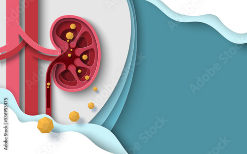Kidney stone human renal disease vector background photo